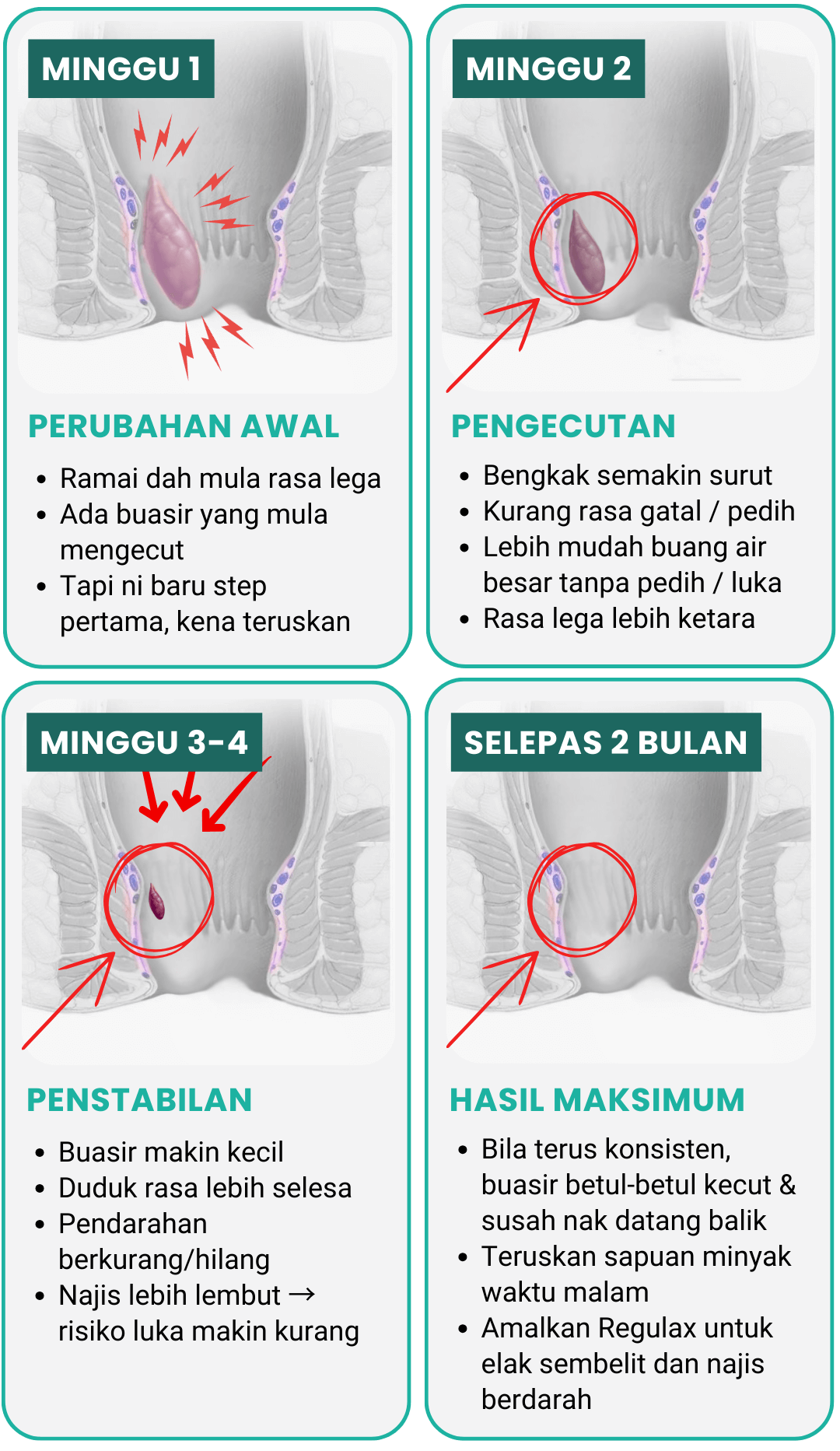 Proses Rawatan Dual-Therapy Buasir Ar-Rizqi